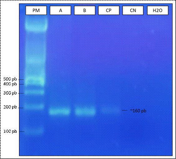 Gel de agarosa 2 % revelado con GelGreen.