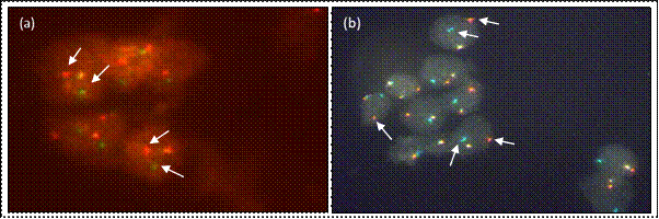 Microscopía de fluorescencia (100X).