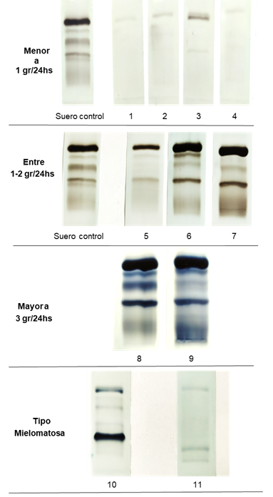 Uroproteinogramas de las orinas ensayadas.