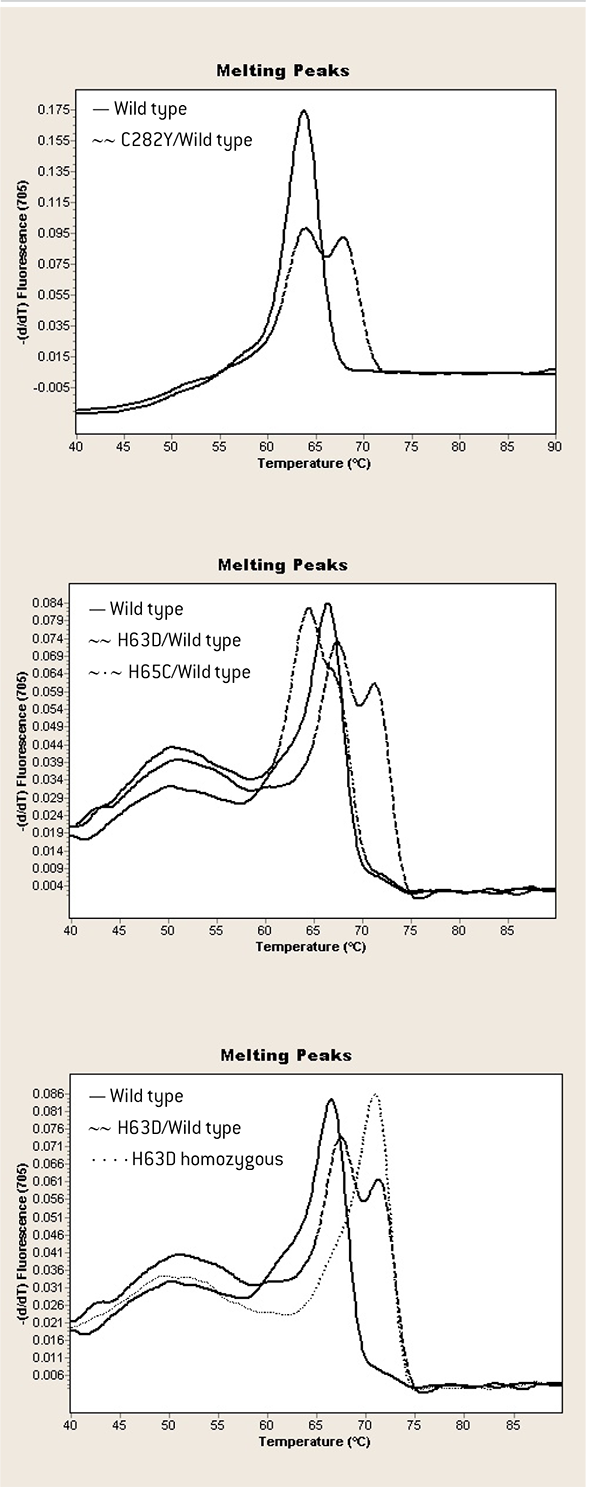 Diferenciación entre los alelos salvajes y mutados del gen HFE mediante la temperatura de melting (Tm).