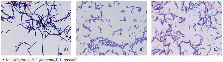 Morfología de Lactobacillus spp.: observación en la coloración de Gram (1000X)